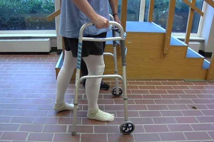 راه رفتن پس از عمل تعویض مفصل زانو