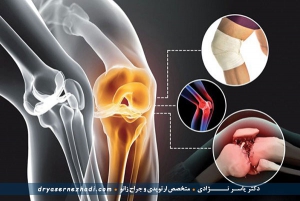 تخریب مفاصل و آرتروز بیشتر در چه افرادی دیده می شود؟