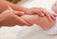 روش های درمان و جراحی پای پرانتزی کودکان