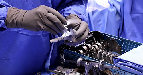ایمپلنت های هوشمند برای جراحی تعویض مفصل زانو